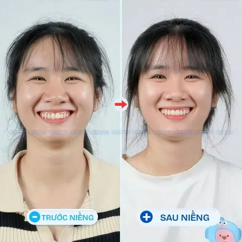 Thay đổi góc nghiêng chỉ cần một quyết định ở mình thôi!