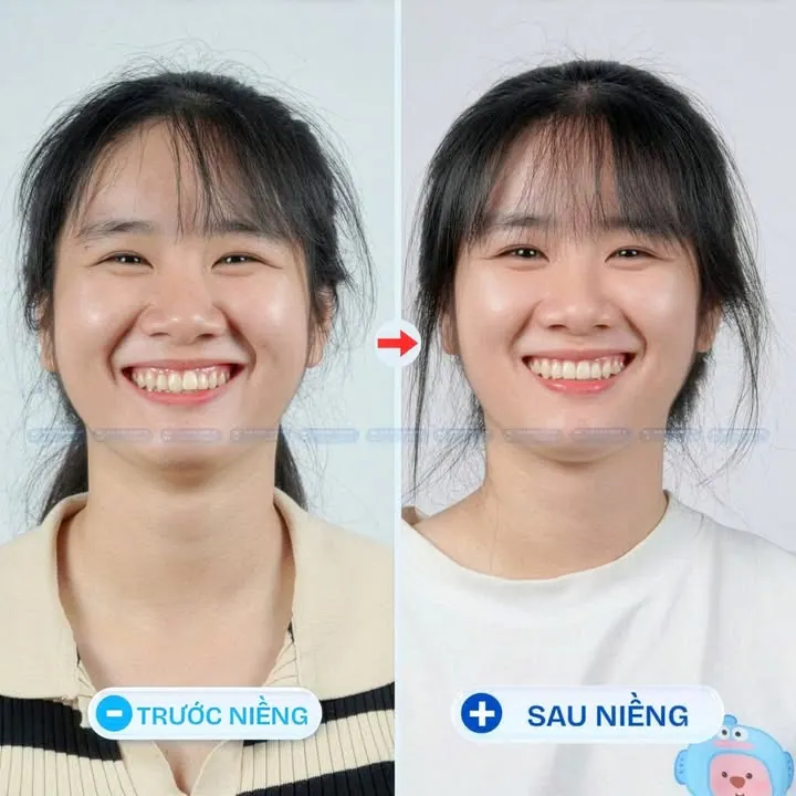 Thay đổi góc nghiêng chỉ cần một quyết định ở mình thôi! – ảnh 1