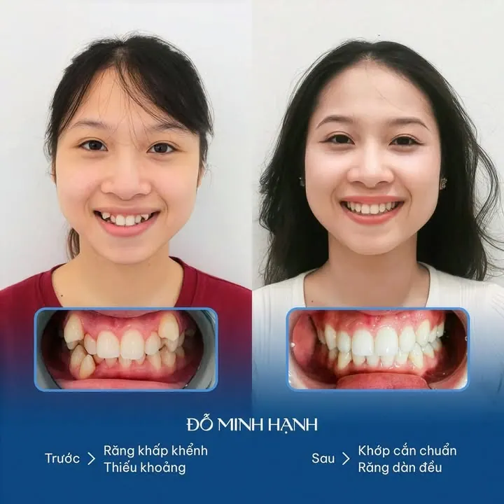 Thay đổi góc nghiêng chỉ cần một quyết định ở mình thôi! – ảnh 3